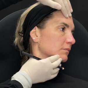 MD Codes™ Foundations: Mid-face Structural Support.